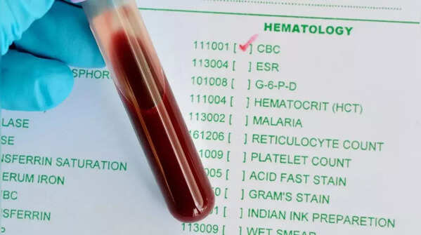 Complete Blood Count (CBC)