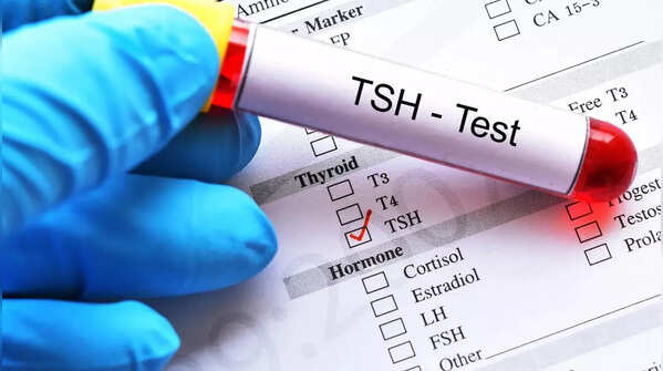 Thyroid Function Tests (TSH, Free T4, Free T3)