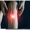 Intermittent bone pain