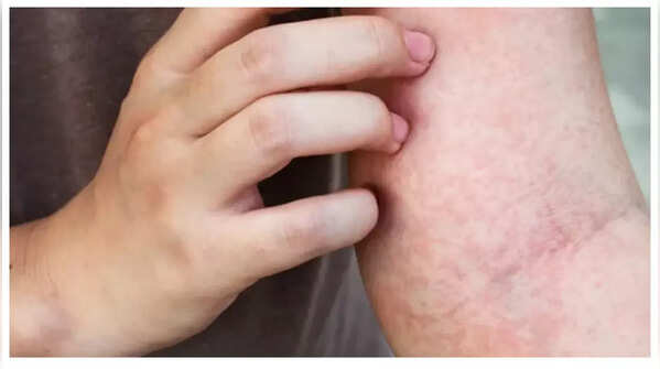 Persistent, Unexplained Itchy Skin