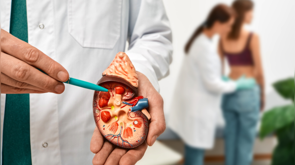 What are some common habits that can be the cause of kidney stones