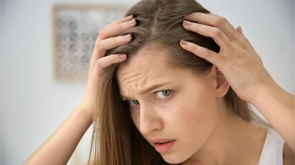 Hair thinning in clumps, not just strands