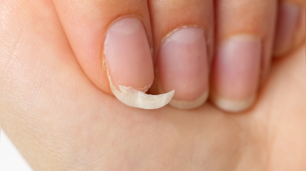 Brittle nails and skin that take time to heal