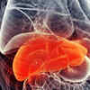 What is fatty liver?