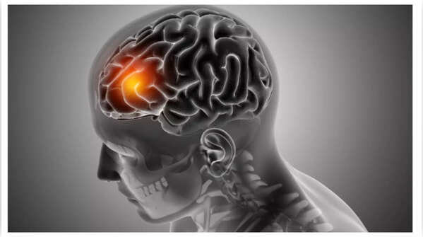 Cognitive and Personality Changes
