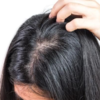 Scalp issues and weakened hair structure