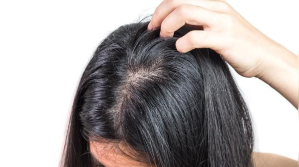 Scalp issues and weakened hair structure