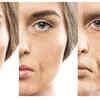 Skin saver