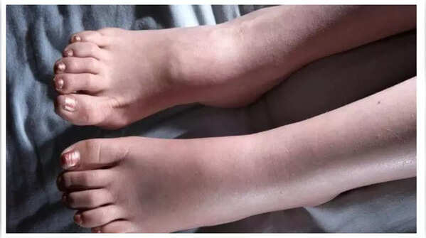 Swelling and water retention