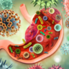 What are the symptoms to watch for?