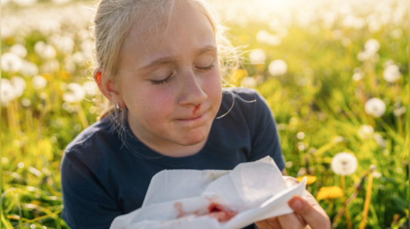 Frequent nosebleeds with easy bruising