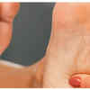 How to Use Magnesium Oil on Your Feet