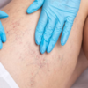 Can CVI hint at other health issues?