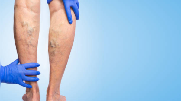 When should you see a doctor?