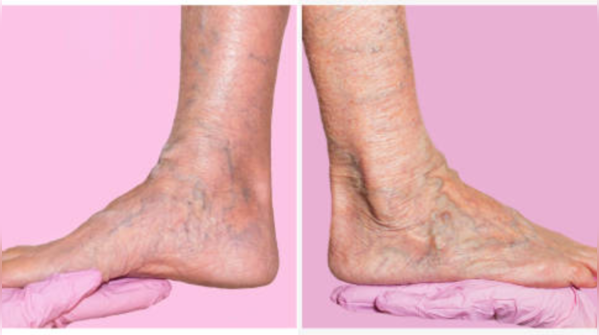 Injuries or surgery:
