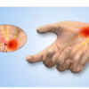 Tingling or Numbness in Hands