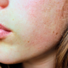 Your skin is dry, flaky, or breaking out