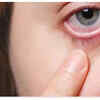 Bulging of One Eye or Visible Lumps
