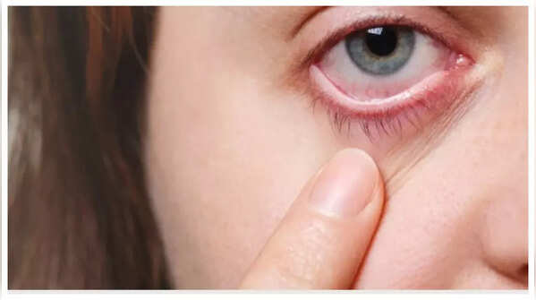 Bulging of One Eye or Visible Lumps