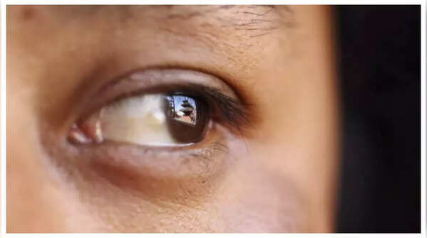 Loss of Peripheral Vision