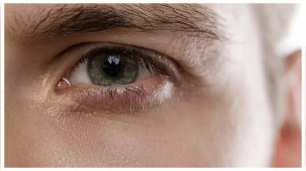Dark Spots on the Colored Part of the Eye