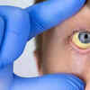 Yellow eyes