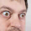 Bulging eyes