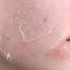 Skin issues or peeling