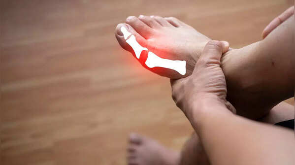Sudden joint pain (Especially in the big toe)