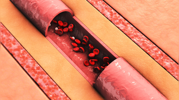 Blood flow, not just steps