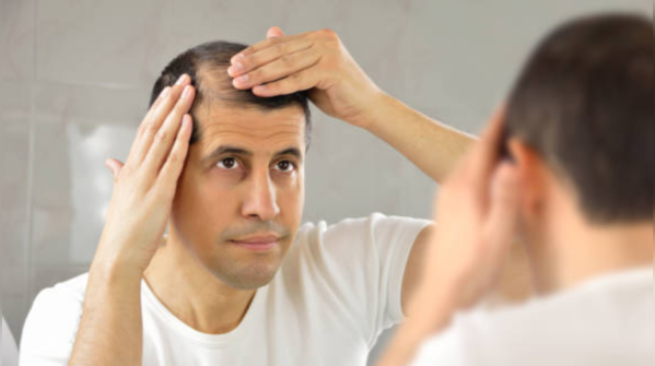 Lifestyle changes for healthy hair:
