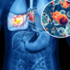 Lung cancer does not happen in youngsters / women