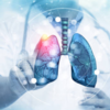 Lung cancer comes only to those who smoke cigarettes