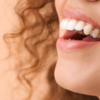 Cracked corners of your mouth (angular cheilitis)