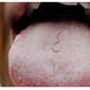 Unusual coating on the tongue