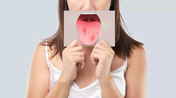 Glossitis and mouth ulcers
