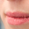 Support for dry and cracked lips (Yes, really!)