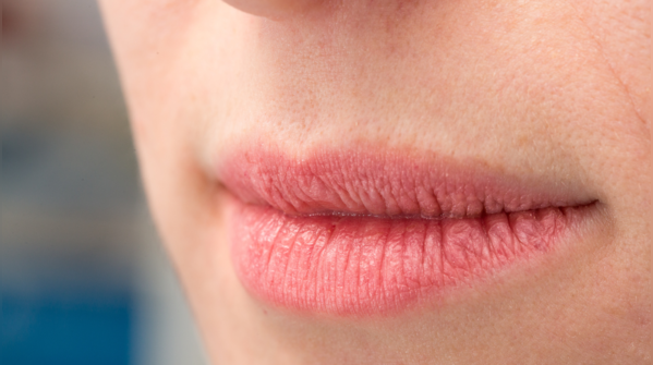 Support for dry and cracked lips (Yes, really!)