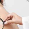Melanoma 