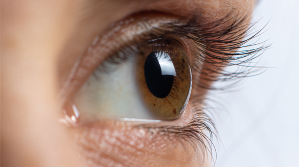 A white or grey ring around the cornea