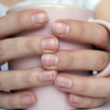 Brittle nails that won’t grow    