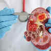 Foods that are good for kidney health