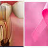 Article image for: Can <i class="tbold">root canal</i> treatment cause Breast Cancer? 5 facts to know