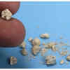 Lump or mass in the kidney area