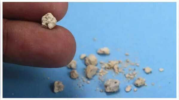 Lump or mass in the kidney area