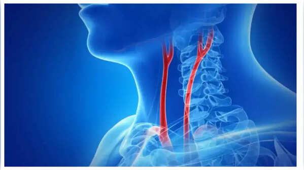 Neck vein distention and swelling