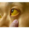 Pale, ashy, or yellowish skin tone