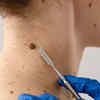 Changes in the skin