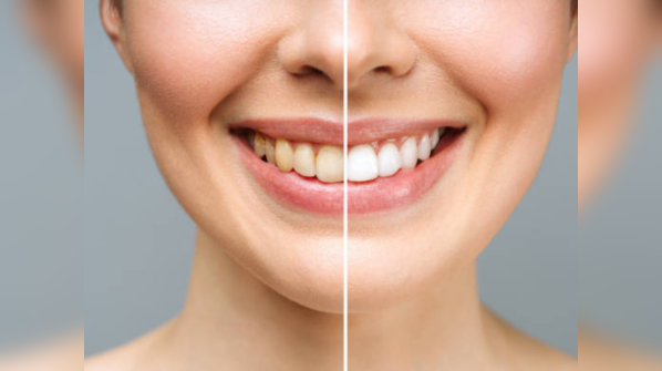 Dental trouble in disguise