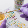 Uric acid: Here's what you don't know about it